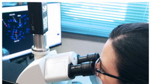 Un gene amico del cuore aiuta a ripararlo dopo un infarto