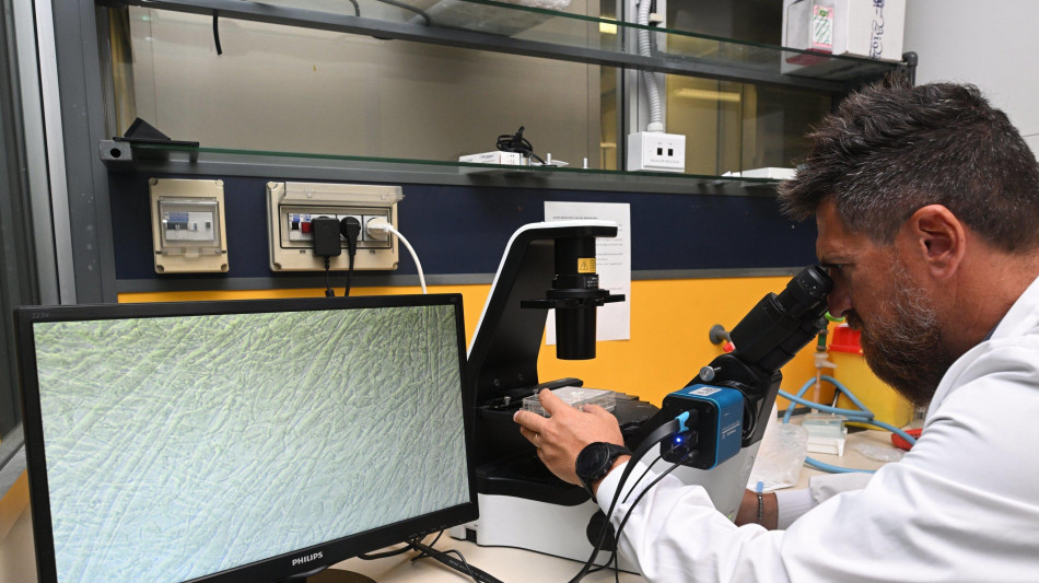 L'effetto brucia-grassi innescato da una staffetta di batteri dell'intestino e dieta