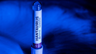 Francia anuncia un caso de hantavirus Andes en un turista franco-argentino