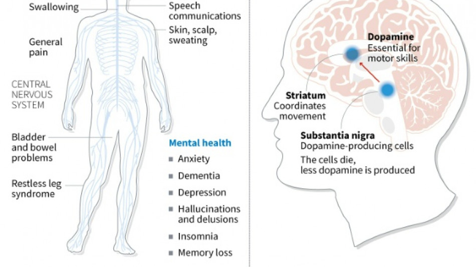 Japan approves stem-cell treatment for Parkinson's in world first