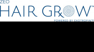 ZEO ScientifiX and Exotropin Join Forces to Launch a Solution to Address the Growing Unmet Need for Hair Loss