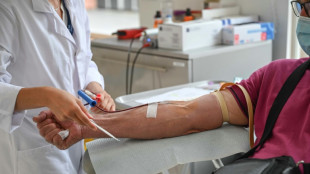Don de plasma: sous perfusion am&eacute;ricaine, la France cherche son ind&eacute;pendance
